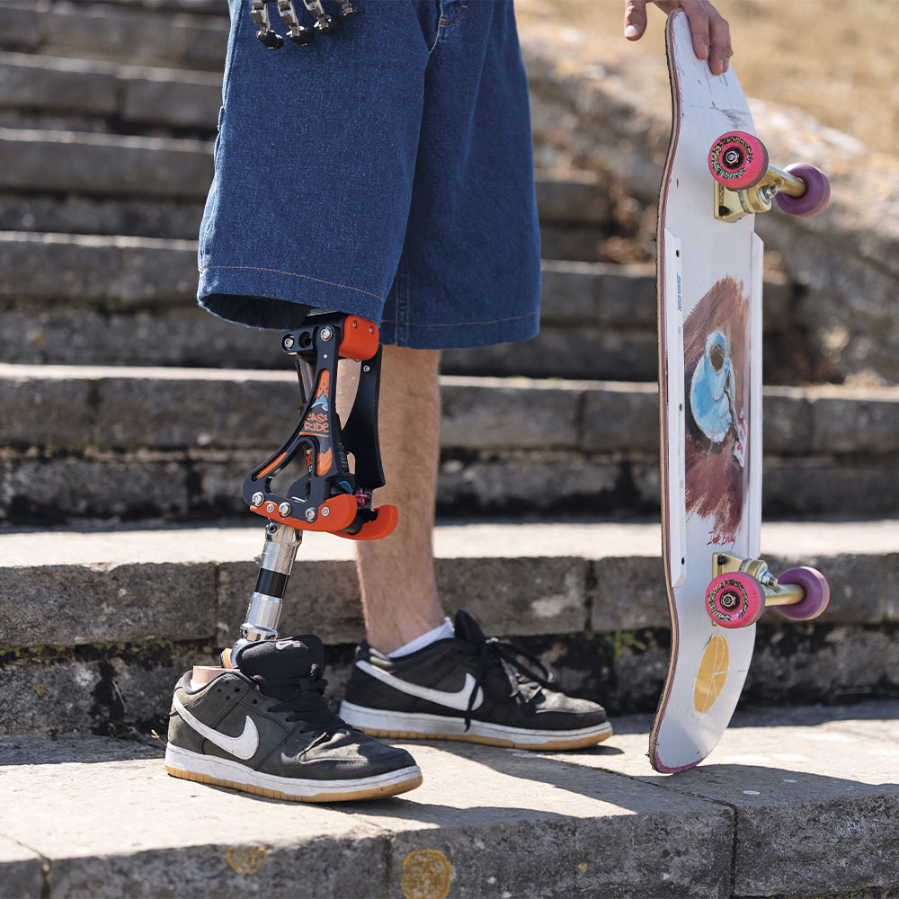 From Set to Skatepark: George’s Inspiring Life as a Congenital Amputee