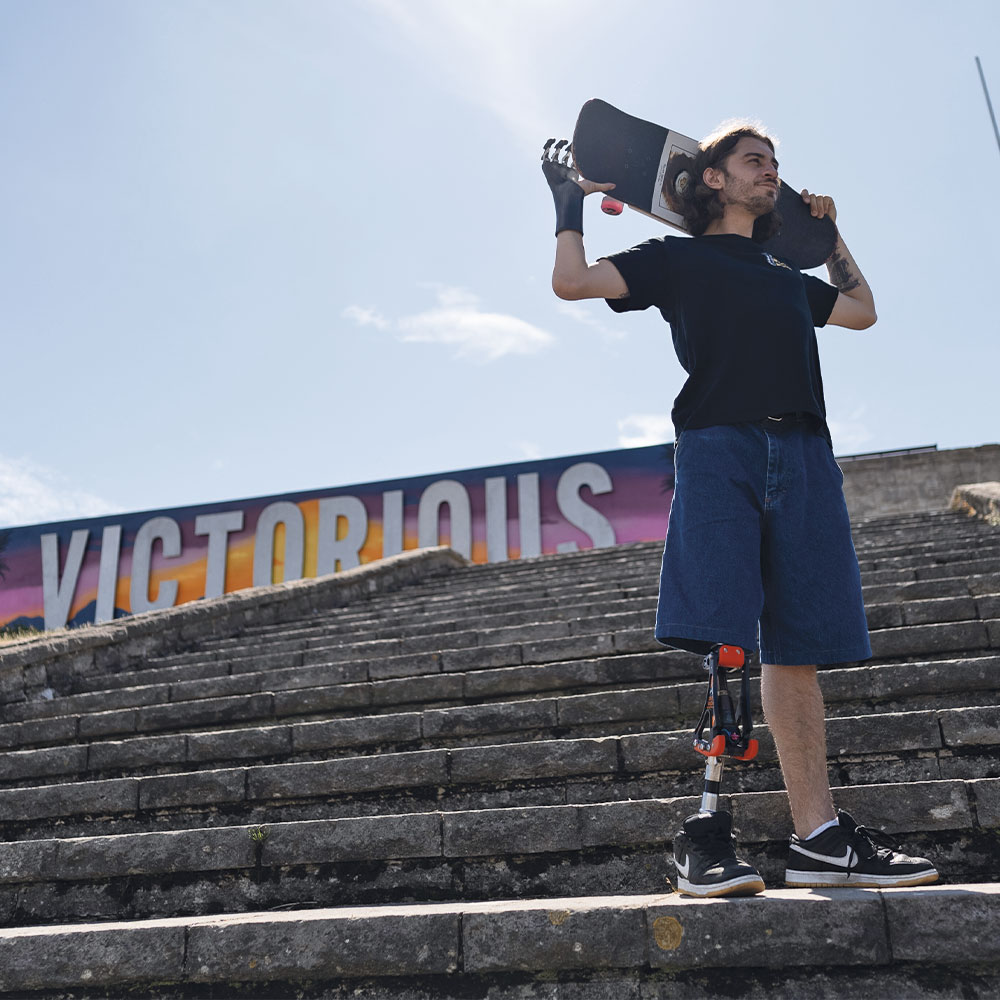 From Set to Skatepark: George’s Inspiring Life as a Congenital Amputee