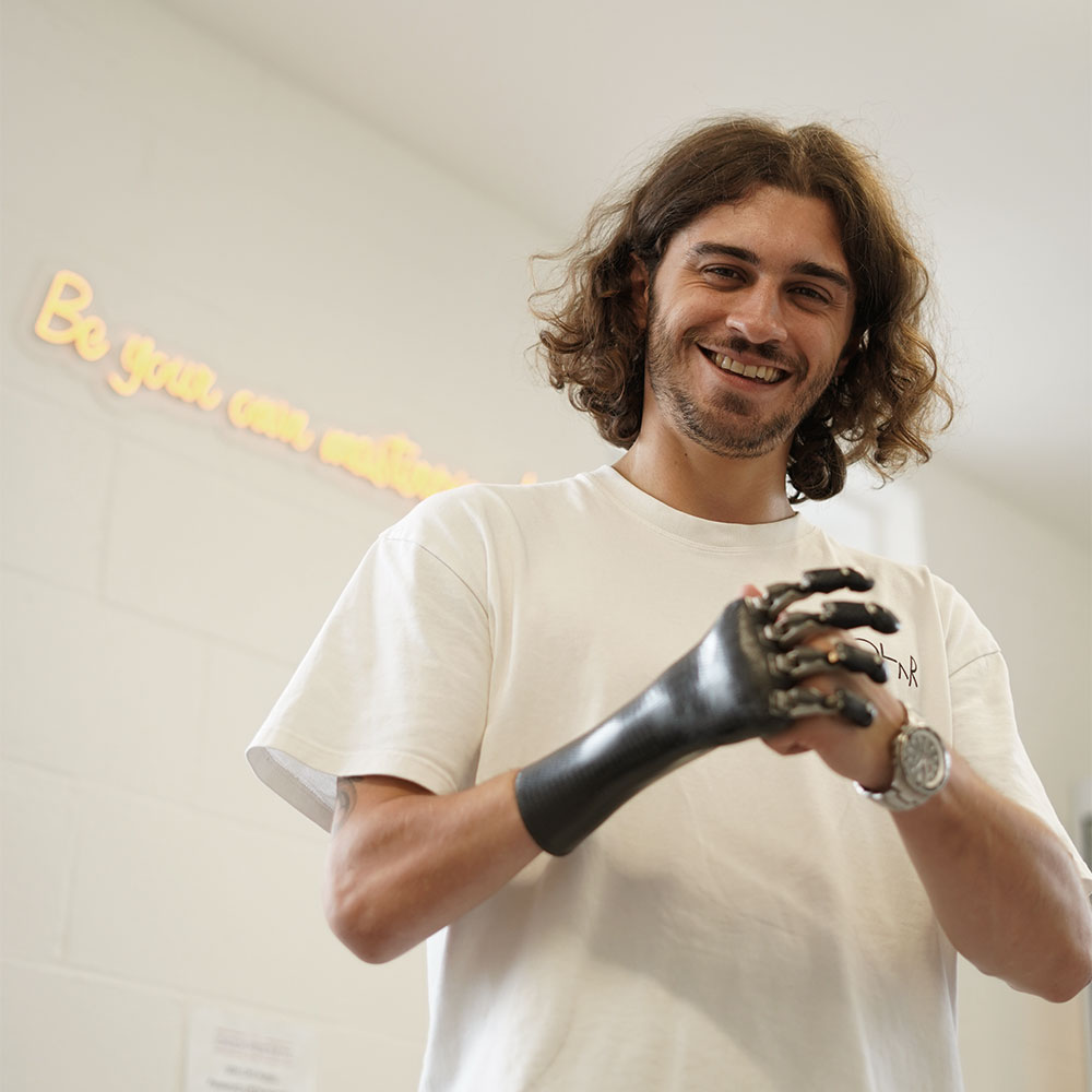 From Set to Skatepark: George’s Inspiring Life as a Congenital Amputee