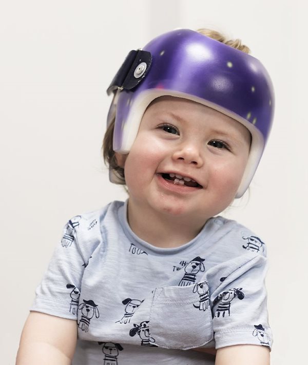 Steeper Clinic Plagiocephaly Helmets Steeper Clinics